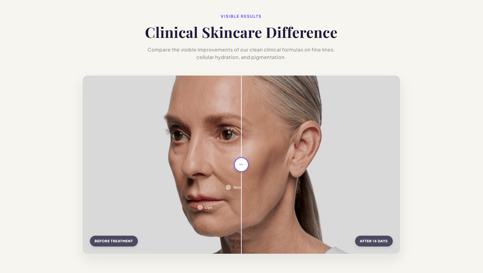 Preview of CS — Before-After #1