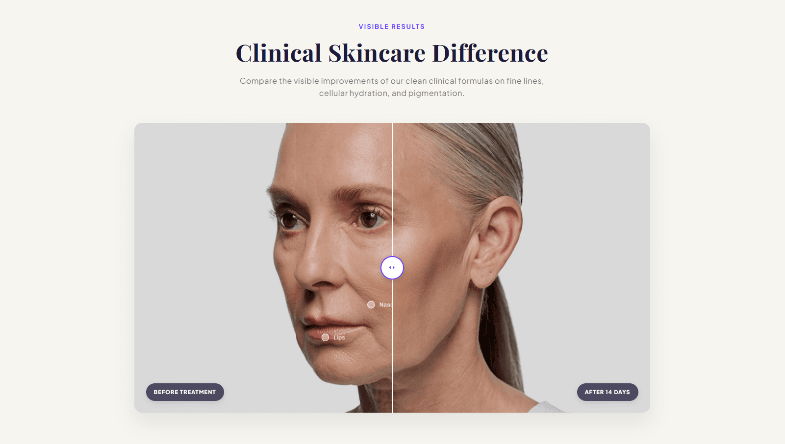 CS — Before-After #1